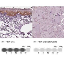KRT6L Antibody, Novus Biologicals 25 &mu;L, Unlabeled:Antibodies, Polyclonal